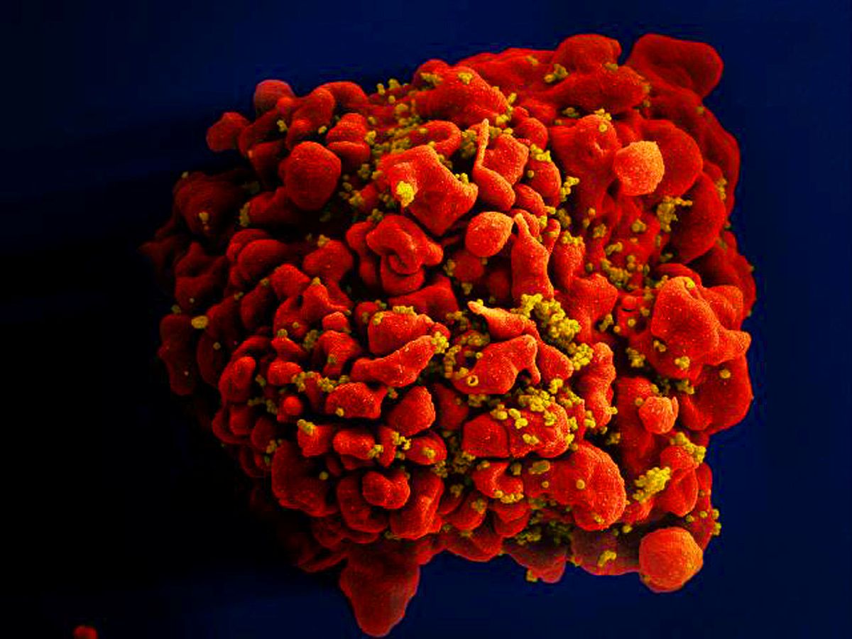 NIH launches clinical trials for three mRNA HIV vaccines